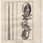 Гравюры. Хирургия. Операция. Медицина. 1780 г. Ч1 — изображение 5